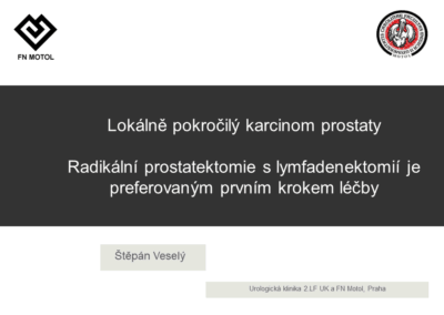 doc. MUDr. Štěpán Veselý Ph.D.: Lokálně pokročilý karcinom prostaty – radikální prostatektomie s lymfadenektomií je preferovaným prvním krokem léčby