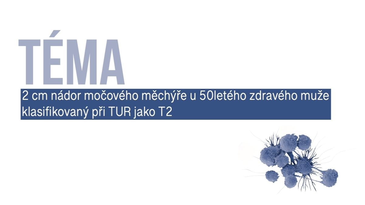 KARCINOM MOČOVÉHO MĚCHÝŘE